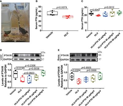 PTH 1-34 promoted bone formation by regulating iron metabolism in unloading-induced bone loss